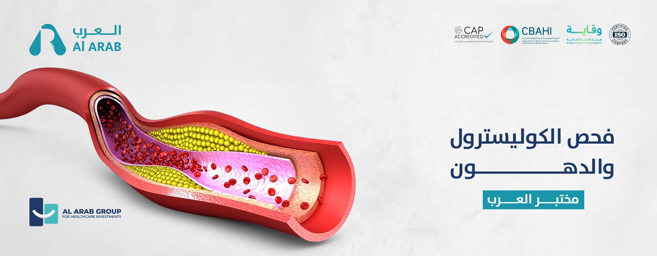 فحص الكوليسترول والدهون – مختبر العرب